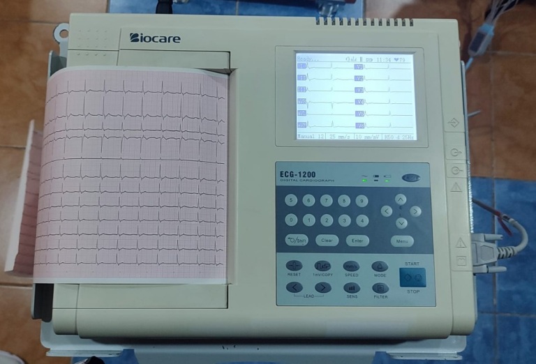 Secondhand Biocare ECG-1200 12 Channel ECG Device - Medbidding