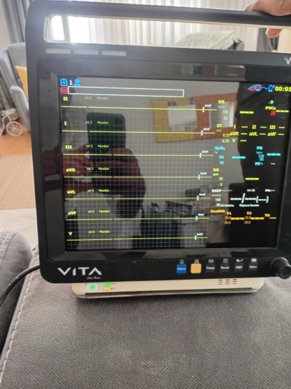 İkinci El Vita V12 Hastabaşı Monitörü - Görsel 2