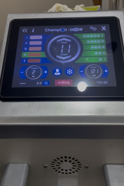 Secondhand Champion Diode Laser Epilation Device - Image 2