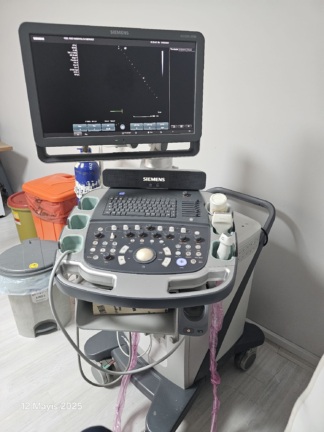 Secondhand Siemens Acuson X700 Ultrasound Machine