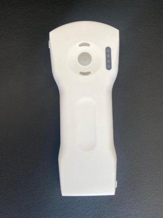 Secondhand Alexus A20HRL Portable Ultrasound Machine