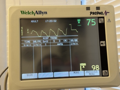 İkinci El Welch Allyn Propaq CS 242 Hastabaşı Monitörü - Görsel 6