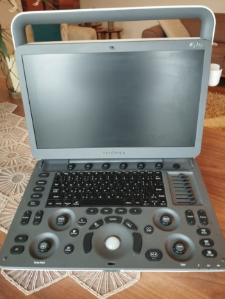 İkinci El Sonoscape E1 EXP Ultrason Cihazı