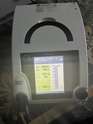 Secondhand Weinmann Ventilogic LS Home Mechanical Ventilator