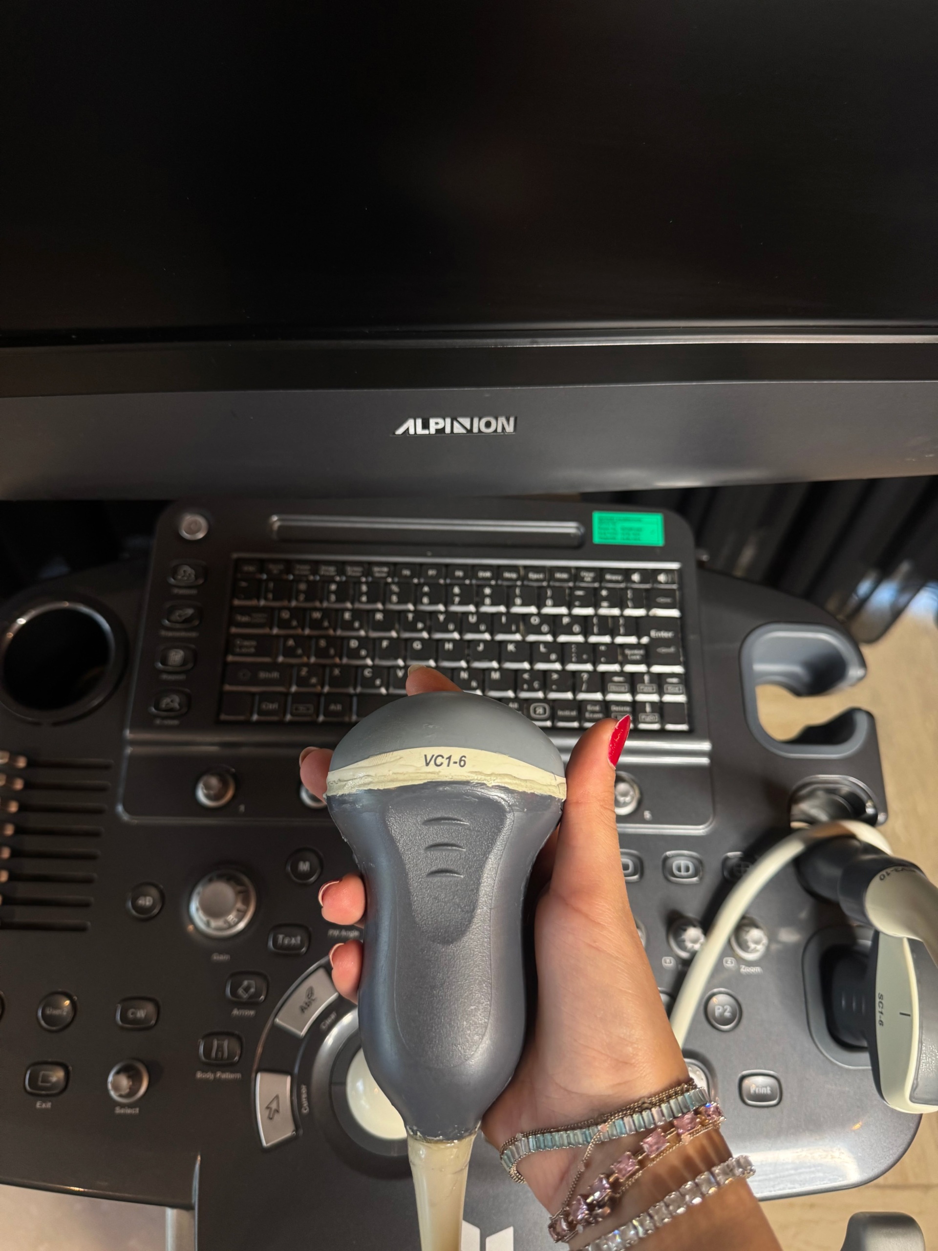 Secondhand Alpinion Ecube 7 Ultrasound Machine - Image 2