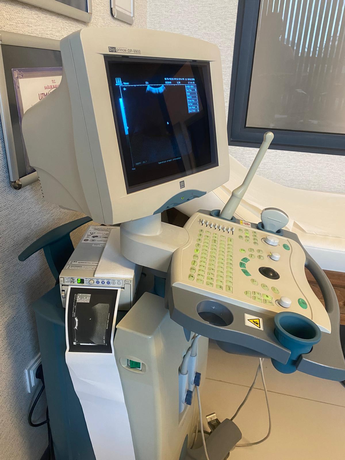 Secondhand Mindray DP-9900 Ultrasound Machine - Image 3