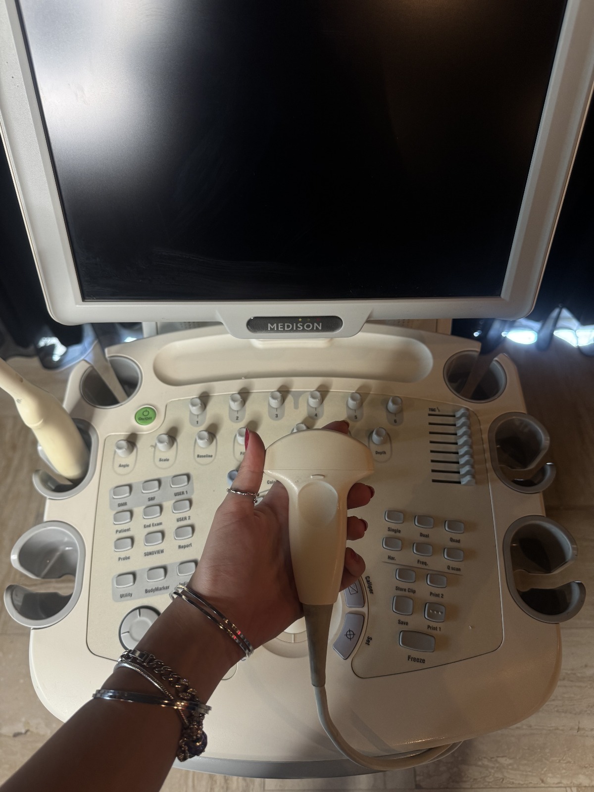 Secondhand Medison Sonoace X8 Ultrasound Machine - Image 3