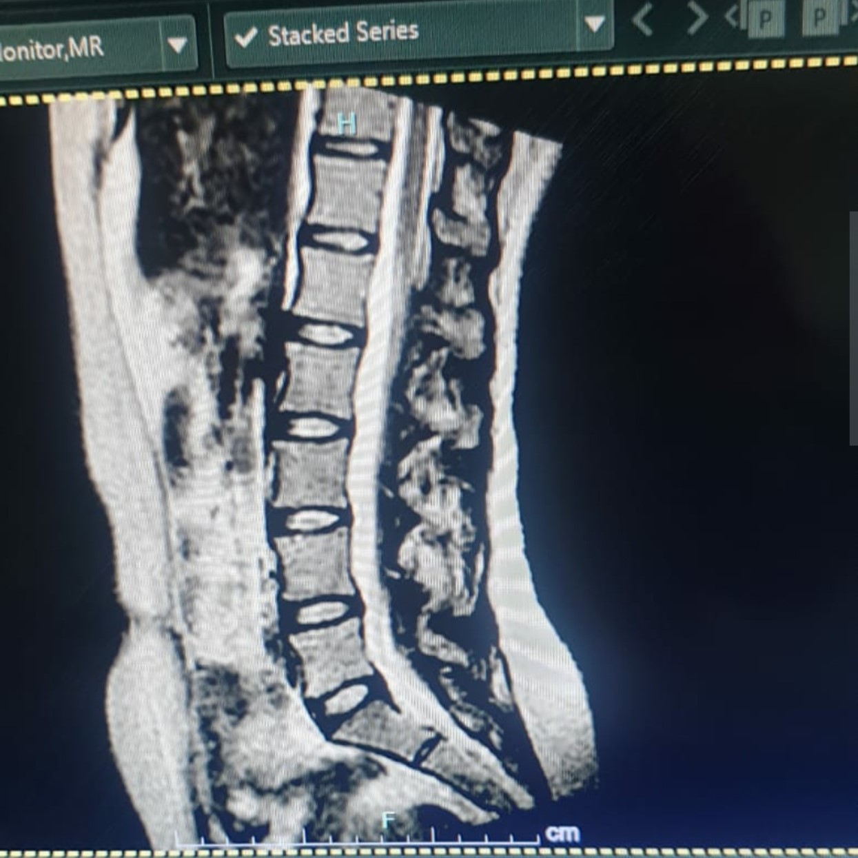 Secondhand GE Ovation 0.35T Open MRI Machine - Image 3
