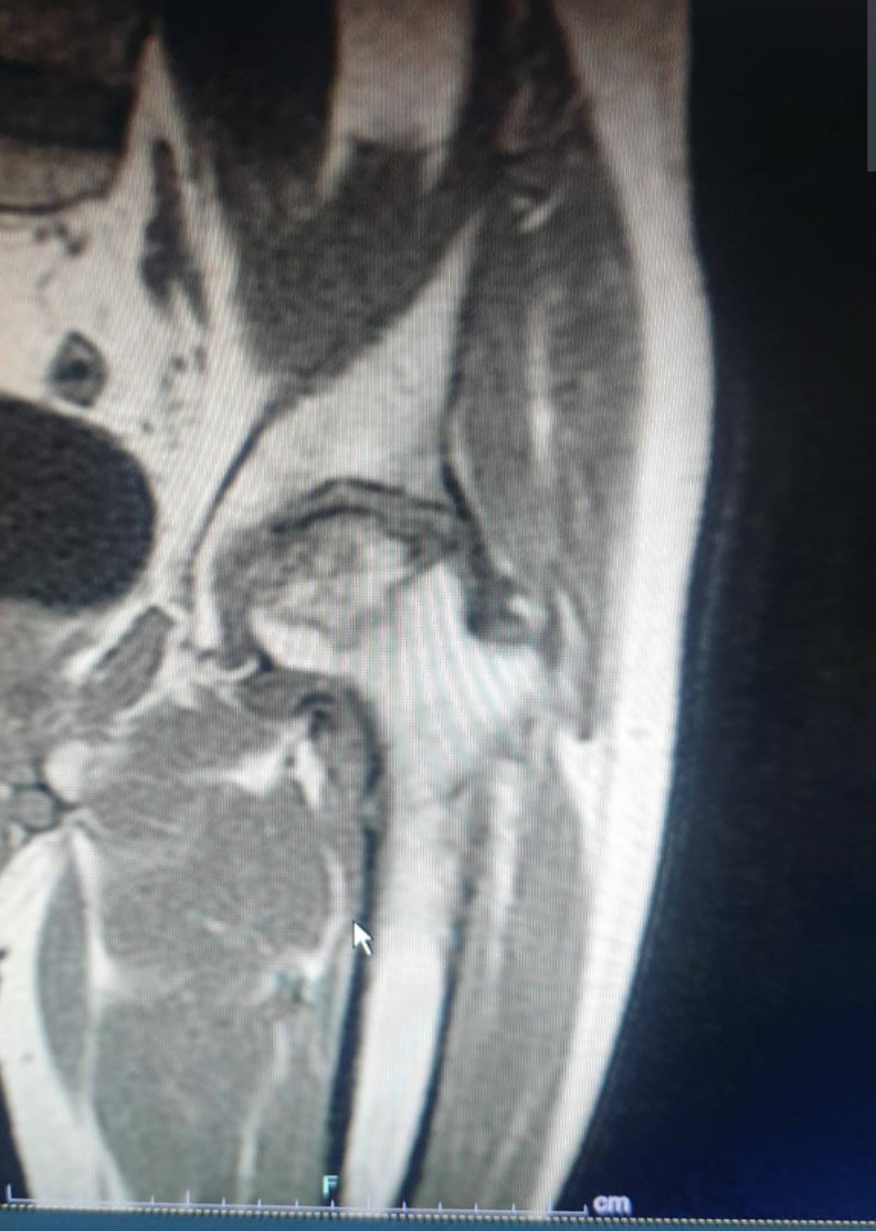 Secondhand GE Ovation 0.35T Open MRI Machine - Image 4