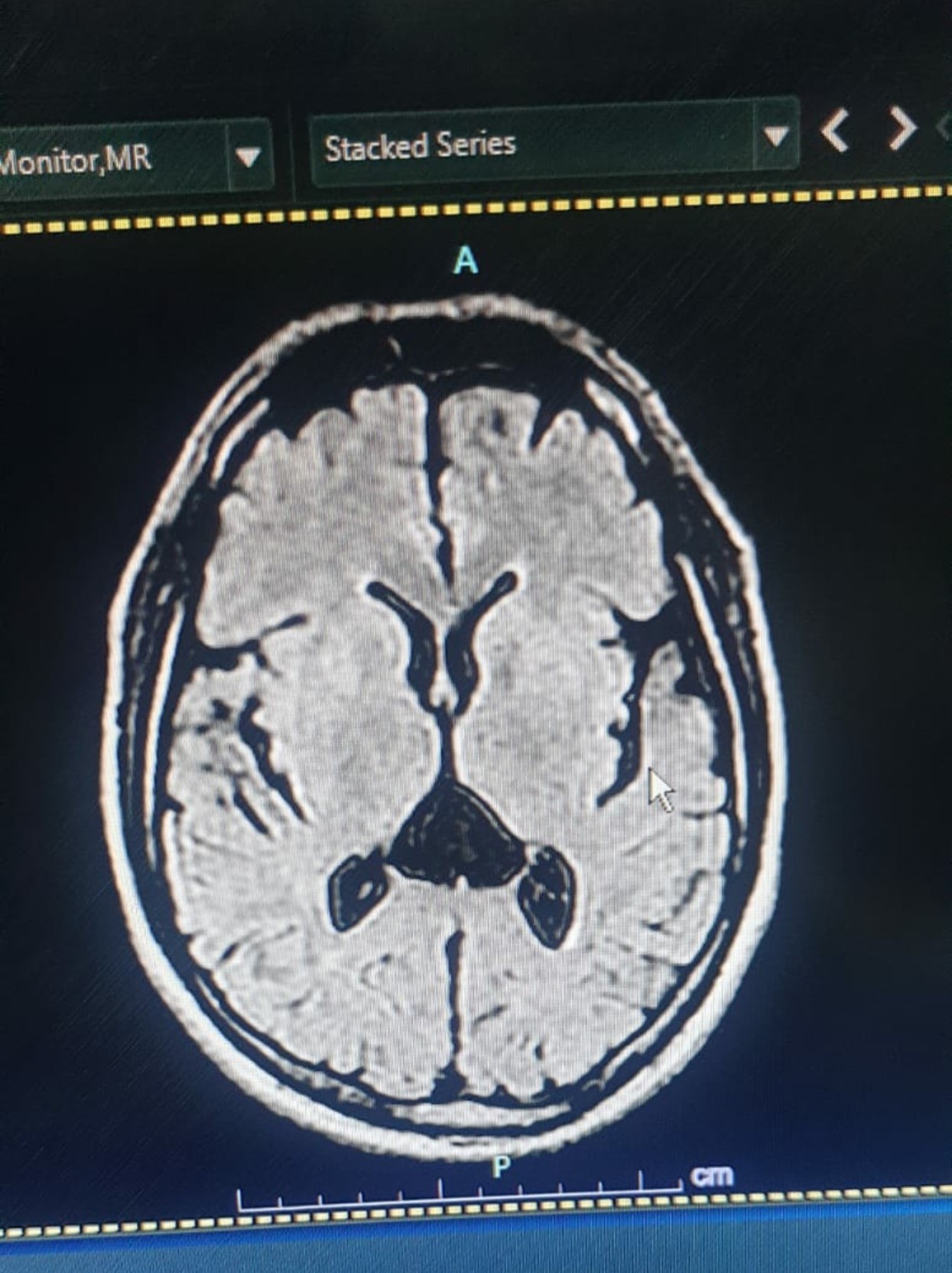 Secondhand GE Ovation 0.35T Open MRI Machine - Image 5