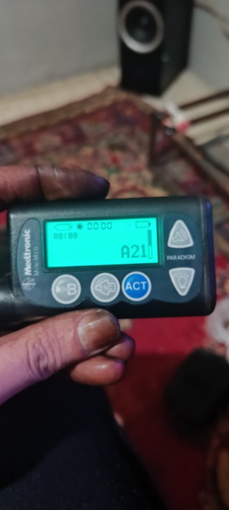 Secondhand Medtronic Minimed Paradigm MMT-715WWS Insulin Pump