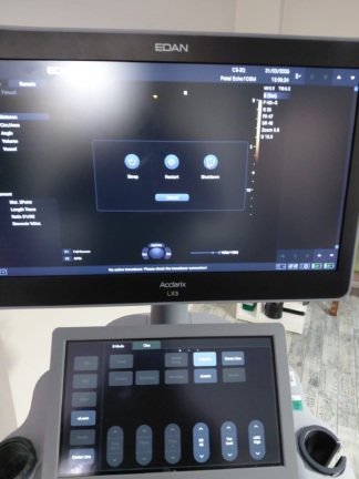 Secondhand Edan Acclarix LX3 Echocardiography Machine