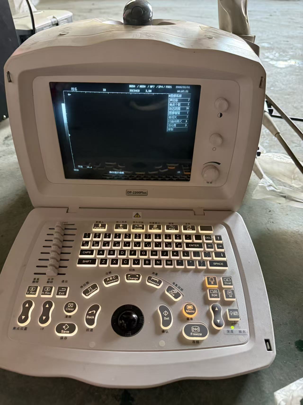 İkinci El Mindray DP-2200 Plus Ultrason Cihazı