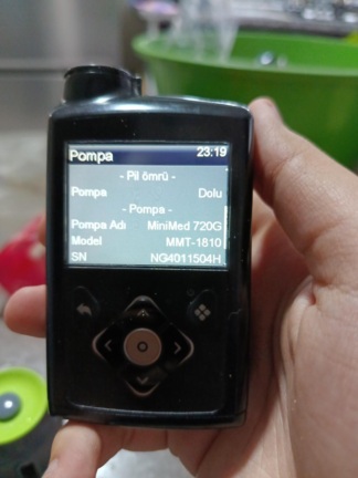 Secondhand Medtronic Minimed 720G Insulin Pump