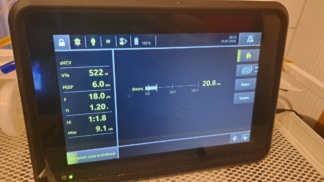 Defective Secondhand Löwenstein Luisa LM150TD Home Mechanical Ventilator
