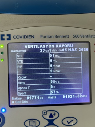 Secondhand Puritan Bennett 560 Home Mechanical Ventilator