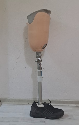 Secondhand Nish Above the Knee Leg Prosthesis