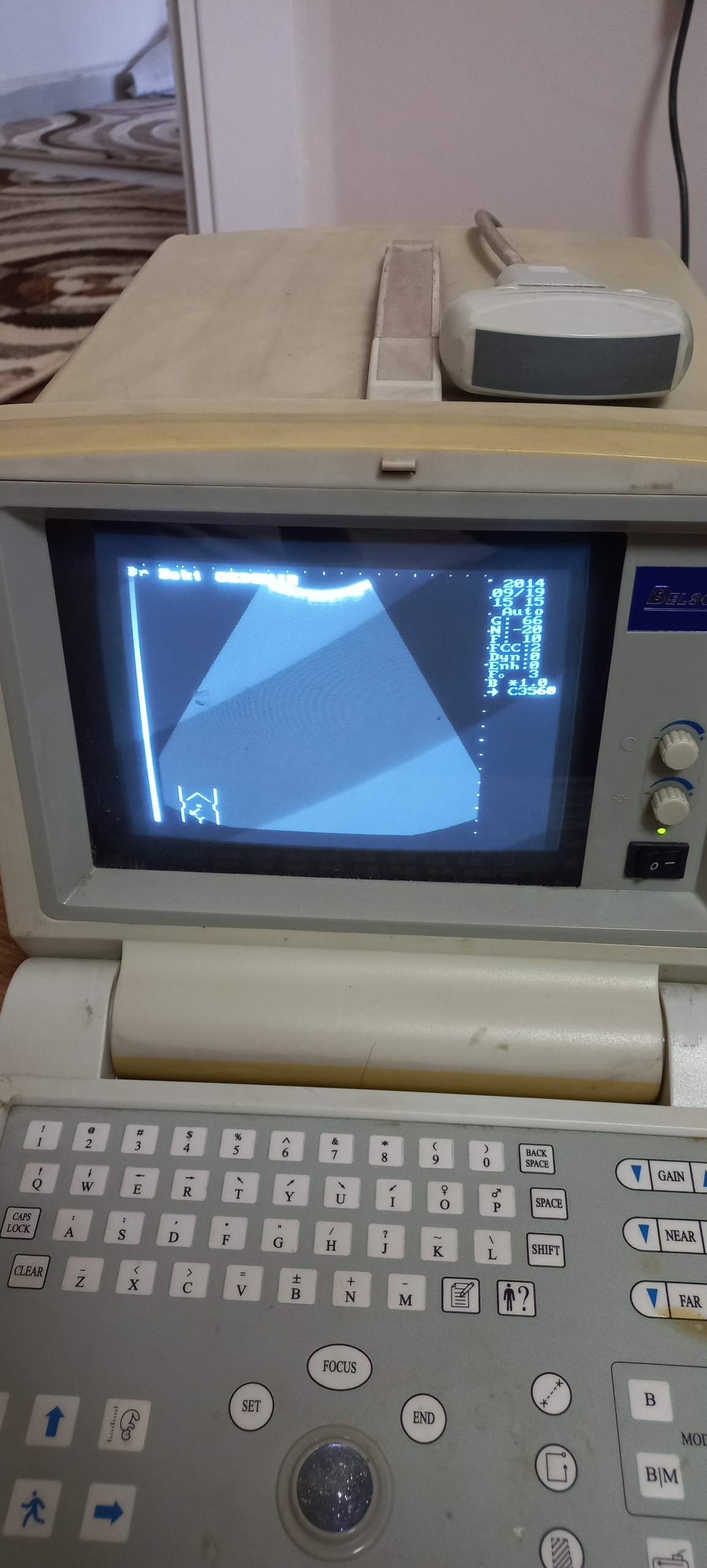 Secondhand Belson 200A Ultrasound Machine - Image 4