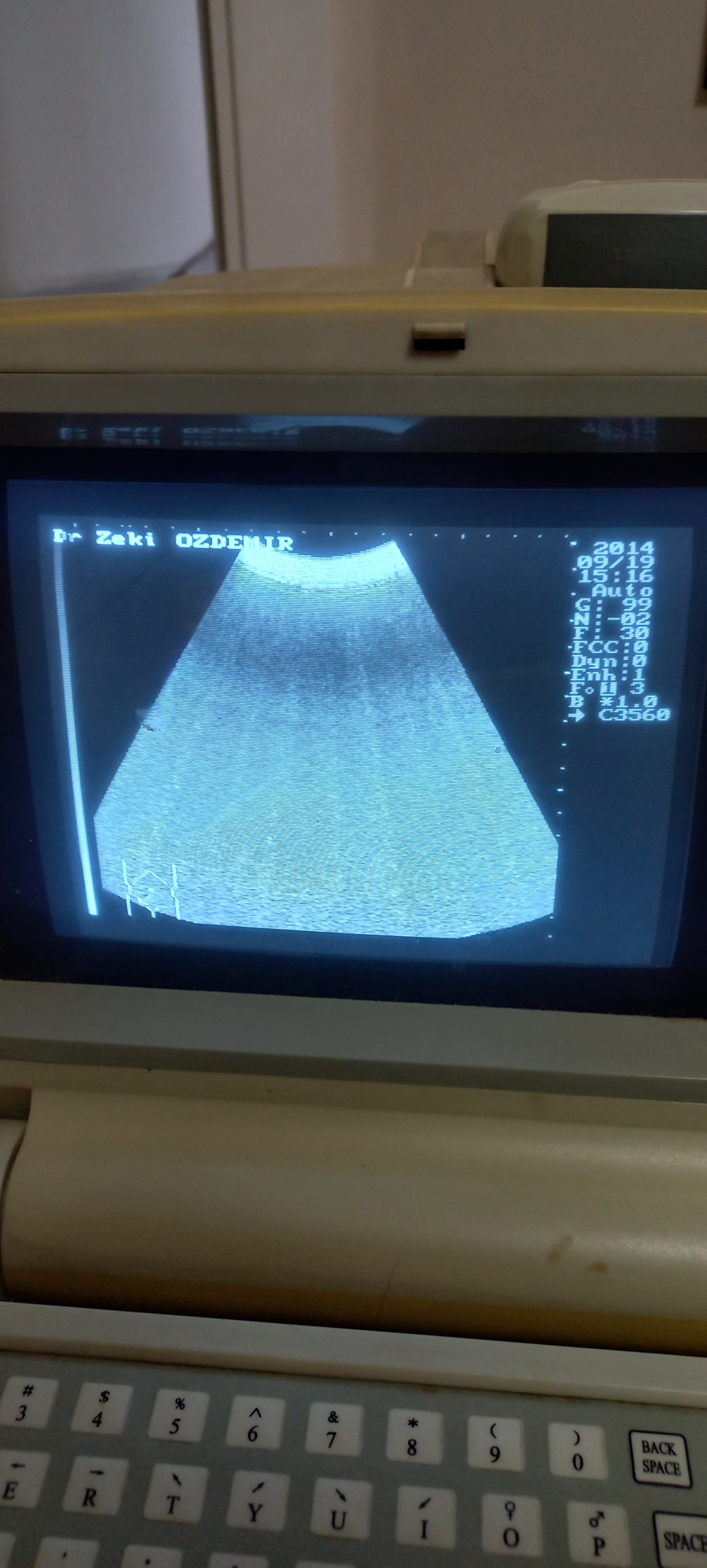 Secondhand Belson 200A Ultrasound Machine - Image 6